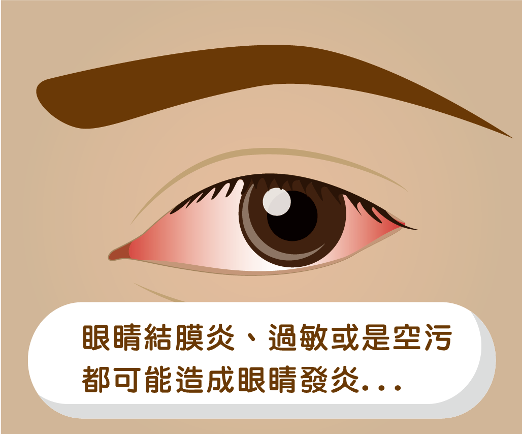點類固醇藥水 慎防眼壓飆高
