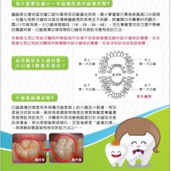 預防蛀牙新主張～齒溝封劑填補