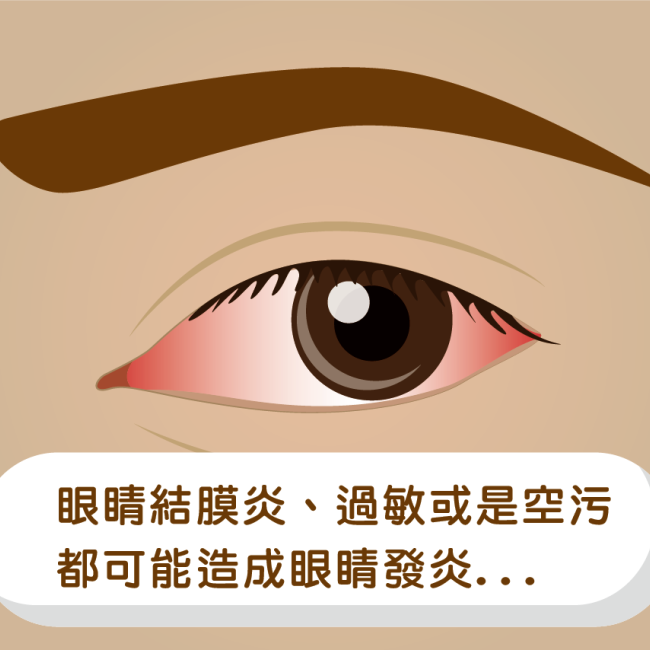 點類固醇藥水 慎防眼壓飆高