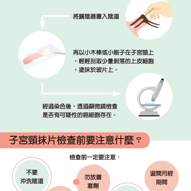 子宮頸抹片檢查